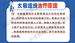 成都西部痛风风湿医院太极埋线：太极针法与现代埋线技